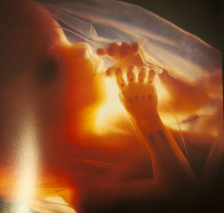 Τμήμα Ιατρικής Εμβρύου